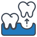 tooth extraction